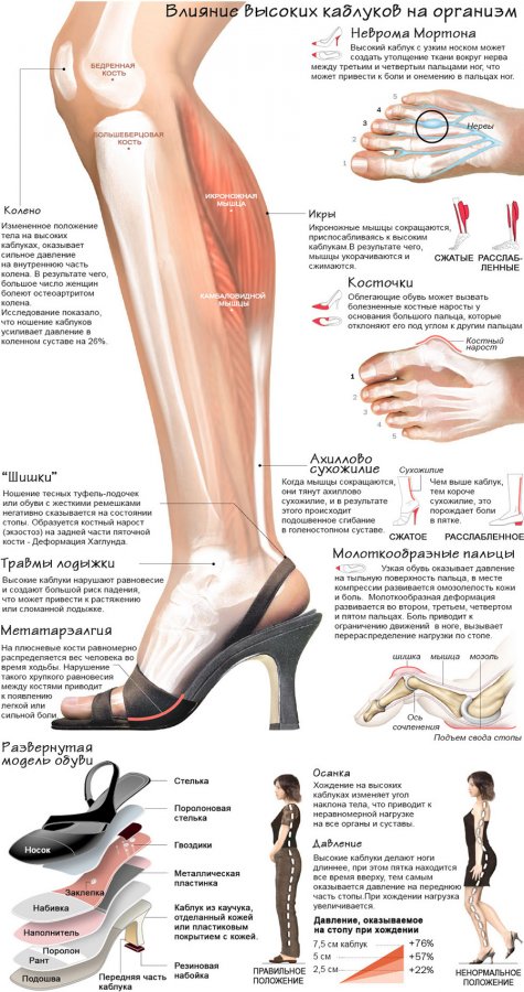 Les chaussures à talons et notre santé