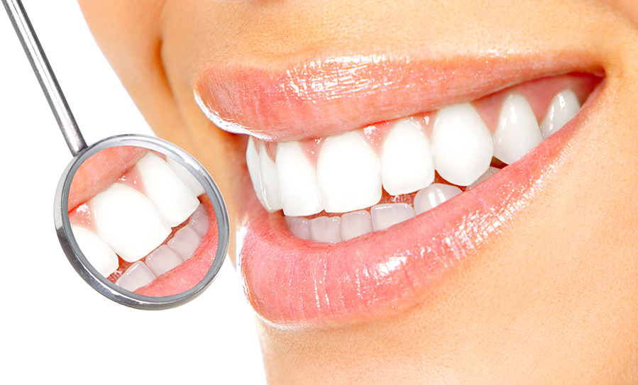 blanchiment des dents à la maison