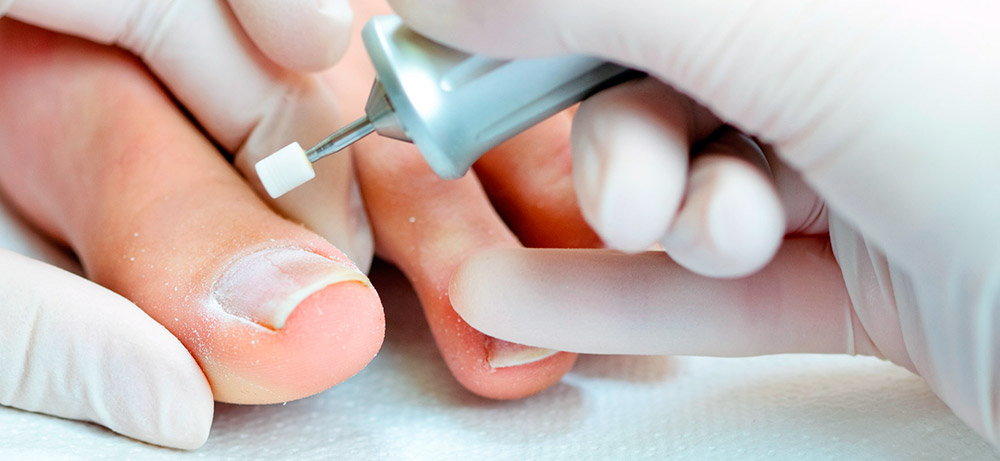 Pédicure matérielle