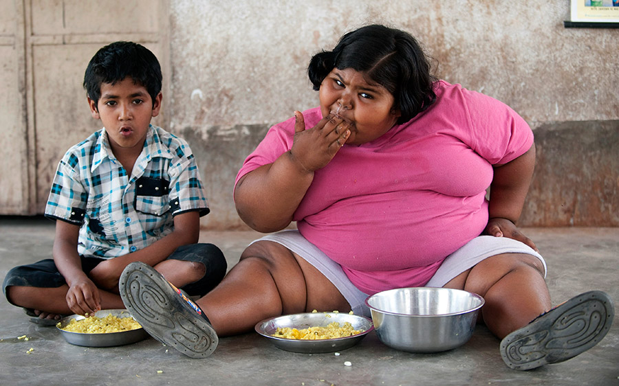 Dépendance alimentaire