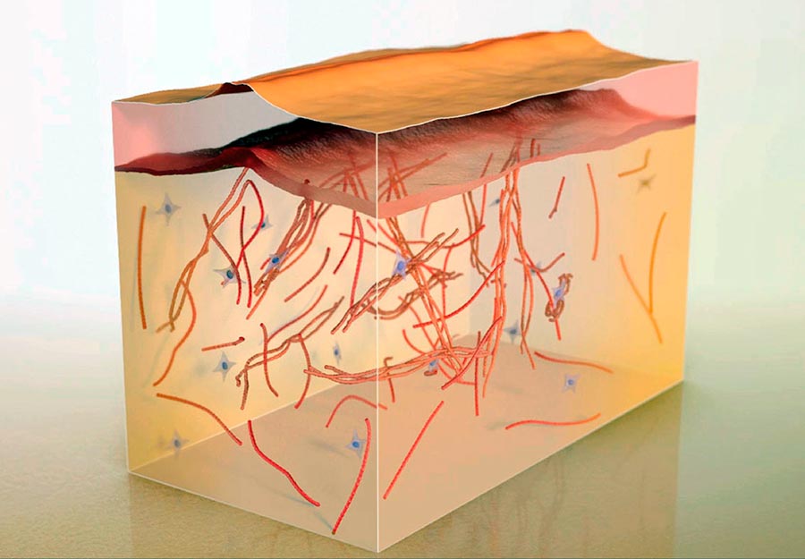 Une technique efficace pour se débarrasser des cicatrices et des cicatrices